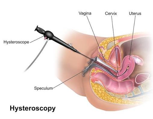 Gynaecological Ultrasonography