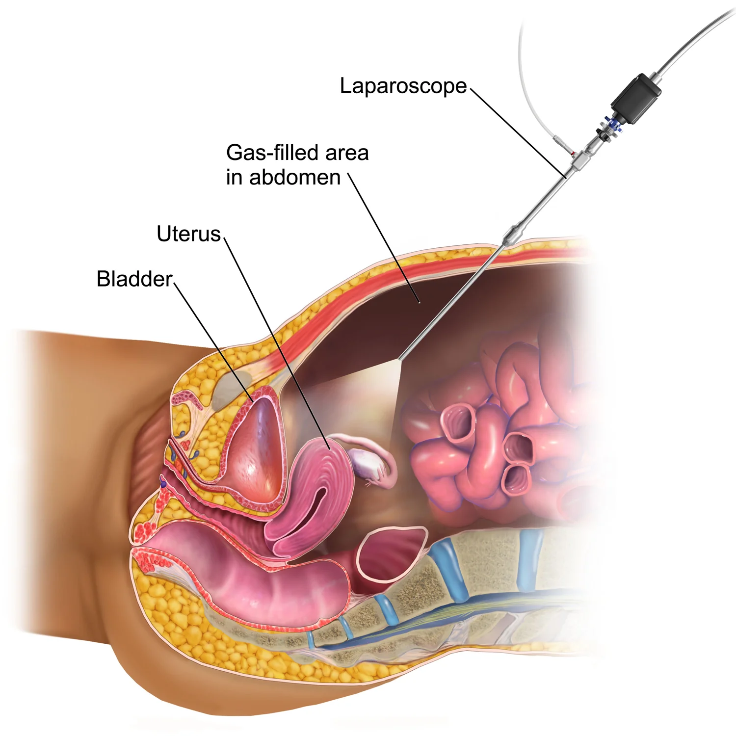 Advanced Laparoscopic Surgery